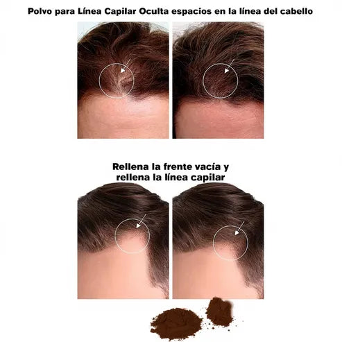 HairRich™ — Rellena tu línea capilar al instante.✨